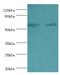 ATP Synthase F1 Subunit Beta antibody, MBS1498946, MyBioSource, Western Blot image 