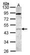 MAPK Activated Protein Kinase 5 antibody, GTX107628, GeneTex, Western Blot image 