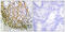 Matrix Metallopeptidase 10 antibody, abx013141, Abbexa, Immunohistochemistry paraffin image 