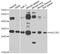 Hepatitis A Virus Cellular Receptor 2 antibody, STJ23914, St John
