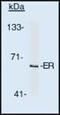 Estrogen Receptor 1 antibody, MA1-12692, Invitrogen Antibodies, Western Blot image 
