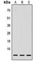 Immunoglobulin Lambda Like Polypeptide 1 antibody, orb256615, Biorbyt, Western Blot image 