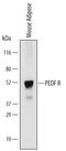 Patatin Like Phospholipase Domain Containing 2 antibody, MAB5365, R&D Systems, Western Blot image 