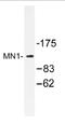 MN1 Proto-Oncogene, Transcriptional Regulator antibody, AP01176PU-N, Origene, Western Blot image 
