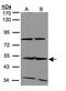 Interferon Induced Protein With Tetratricopeptide Repeats 2 antibody, PA5-28800, Invitrogen Antibodies, Western Blot image 