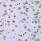 Cytosolic Iron-Sulfur Assembly Component 1 antibody, LS-C349080, Lifespan Biosciences, Immunohistochemistry paraffin image 