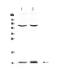 S100 Calcium Binding Protein A10 antibody, A02787-2, Boster Biological Technology, Western Blot image 