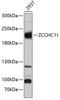 Terminal uridylyltransferase 4 antibody, GTX66474, GeneTex, Western Blot image 