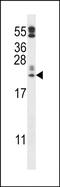 Peroxiredoxin Like 2A antibody, PA5-48580, Invitrogen Antibodies, Western Blot image 