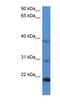 Inner Mitochondrial Membrane Peptidase Subunit 2 antibody, NBP1-79838, Novus Biologicals, Western Blot image 