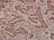 S100 Calcium Binding Protein A1 antibody, A02503S100, Boster Biological Technology, Immunohistochemistry paraffin image 