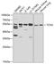 Transcobalamin 2 antibody, GTX16437, GeneTex, Western Blot image 