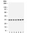 Catechol-O-Methyltransferase antibody, R32010, NSJ Bioreagents, Western Blot image 
