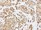 ADP Ribosylation Factor Like GTPase 14 antibody, LS-C186006, Lifespan Biosciences, Immunohistochemistry paraffin image 