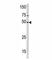 PXK protein antibody, F40080-0.4ML, NSJ Bioreagents, Western Blot image 