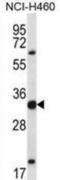 Homeobox C9 antibody, abx027944, Abbexa, Western Blot image 