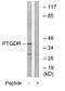 Prostaglandin D2 receptor antibody, GTX00621, GeneTex, Western Blot image 