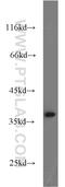 G Protein Subunit Beta 1 antibody, 10247-2-AP, Proteintech Group, Western Blot image 