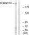 Tubulin Gamma Complex Associated Protein 6 antibody, A30694, Boster Biological Technology, Western Blot image 