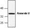 Annexin A5 antibody, GTX59627, GeneTex, Western Blot image 