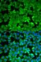 Asparagine Synthetase (Glutamine-Hydrolyzing) antibody, LS-B13908, Lifespan Biosciences, Immunofluorescence image 