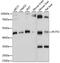 Phosphate Cytidylyltransferase 2, Ethanolamine antibody, GTX66356, GeneTex, Western Blot image 