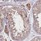 Zinc Finger MYM-Type Containing 4 antibody, NBP2-13550, Novus Biologicals, Immunohistochemistry paraffin image 