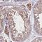 Zinc Finger MYM-Type Containing 4 antibody, NBP2-13550, Novus Biologicals, Immunohistochemistry paraffin image 