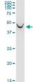 Branched Chain Amino Acid Transaminase 1 antibody, H00000586-M02, Novus Biologicals, Western Blot image 