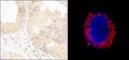 ABL Proto-Oncogene 1, Non-Receptor Tyrosine Kinase antibody, A301-660A, Bethyl Labs, Immunocytochemistry image 