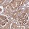 Coatomer Protein Complex Subunit Gamma 1 antibody, PA5-58146, Invitrogen Antibodies, Immunohistochemistry frozen image 