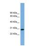 Regulator Of Calcineurin 2 antibody, NBP1-79477, Novus Biologicals, Western Blot image 