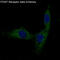 Platelet Derived Growth Factor Receptor Beta antibody, M00096-1, Boster Biological Technology, Immunofluorescence image 
