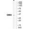 Odd-Skipped Related Transciption Factor 2 antibody, A08057, Boster Biological Technology, Western Blot image 