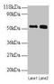 Bone Morphogenetic Protein 3 antibody, LS-C285461, Lifespan Biosciences, Western Blot image 