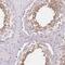 TBC1 Domain Family Member 9 antibody, NBP2-13415, Novus Biologicals, Immunohistochemistry paraffin image 
