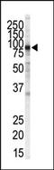 Inhibitor Of Nuclear Factor Kappa B Kinase Subunit Beta antibody, AM11078PU-N, Origene, Western Blot image 