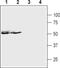 Purinergic Receptor P2X 5 antibody, PA5-77683, Invitrogen Antibodies, Western Blot image 