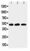 Hyaluronidase 1 antibody, LS-C343927, Lifespan Biosciences, Western Blot image 