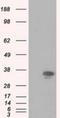 Pim-2 Proto-Oncogene, Serine/Threonine Kinase antibody, NBP2-02441, Novus Biologicals, Western Blot image 