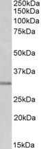 Msh Homeobox 1 antibody, PA5-18284, Invitrogen Antibodies, Western Blot image 