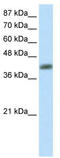 Aprataxin antibody, TA345604, Origene, Western Blot image 