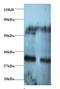 Rho/Rac Guanine Nucleotide Exchange Factor 18 antibody, LS-B11401, Lifespan Biosciences, Western Blot image 