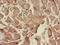 Solute Carrier Family 12 Member 7 antibody, LS-C679469, Lifespan Biosciences, Immunohistochemistry paraffin image 