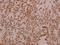 Collagen Type V Alpha 1 Chain antibody, GTX66675, GeneTex, Immunohistochemistry paraffin image 