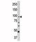 Carnitine Palmitoyltransferase 1A antibody, F48084-0.4ML, NSJ Bioreagents, Immunohistochemistry paraffin image 