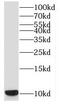 Small Nuclear Ribonucleoprotein Polypeptide F antibody, FNab08077, FineTest, Western Blot image 