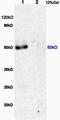 Macrophage Scavenger Receptor 1 antibody, orb100585, Biorbyt, Western Blot image 