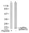 Cofilin 1 antibody, AP02426PU-N, Origene, Western Blot image 