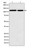 Matrin 3 antibody, M02931-1, Boster Biological Technology, Western Blot image 